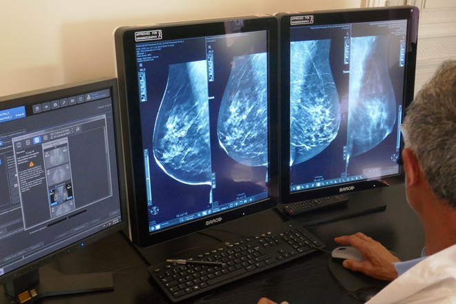 Le centre de radiologie CSE fiabilise la détection de cancer du sein grâce à l’intelligence artificielle